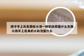 孩子手上长出类似小泡一样的白斑是什么东西 小孩手上出来的小白泡是什么