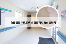 白僵蚕治疗银屑病 白僵蚕可以美白淡斑吗