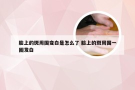 脸上的斑周围变白是怎么了 脸上的斑周围一圈发白