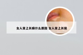 女人背上长癣什么原因 女人背上长侯