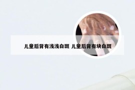 儿童后背有浅浅白斑 儿童后背有块白斑