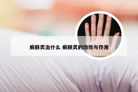 癣肤灵治什么 癣肤灵的功效与作用