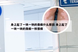 身上起了一块一块的像癣什么原因 身上起了一块一块的像癣一样很痒