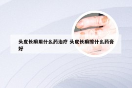 头皮长癣用什么药治疗 头皮长癣擦什么药膏好