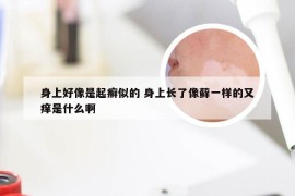 身上好像是起癣似的 身上长了像藓一样的又痒是什么啊