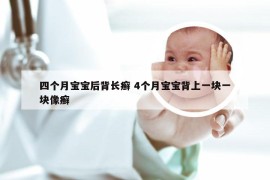 四个月宝宝后背长癣 4个月宝宝背上一块一块像癣