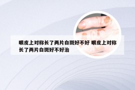 眼皮上对称长了两片白斑好不好 眼皮上对称长了两片白斑好不好治