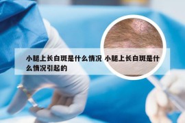 小腿上长白斑是什么情况 小腿上长白斑是什么情况引起的