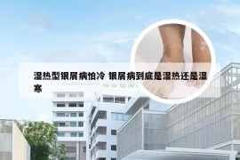 湿热型银屑病怕冷 银屑病到底是湿热还是湿寒