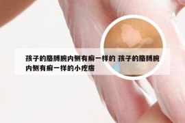 孩子的胳膊腕内侧有癣一样的 孩子的胳膊腕内侧有癣一样的小疙瘩