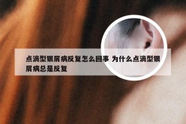 点滴型银屑病反复怎么回事 为什么点滴型银屑病总是反复