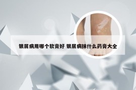 银屑病用哪个软膏好 银屑病抹什么药膏大全