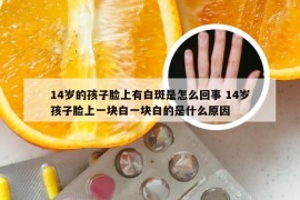 14岁的孩子脸上有白斑是怎么回事 14岁孩子脸上一块白一块白的是什么原因