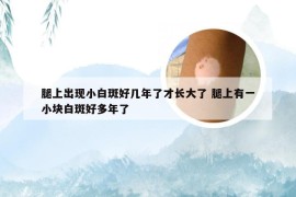 腿上出现小白斑好几年了才长大了 腿上有一小块白斑好多年了