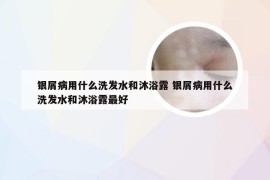 银屑病用什么洗发水和沐浴露 银屑病用什么洗发水和沐浴露最好