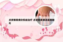 点状银屑病分阶段治疗 点状银屑病消退期图片