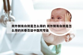 阴外侧有白斑是怎么得的 阴外侧有白斑是怎么得的长春百益中医院专业