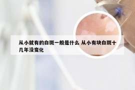 从小就有的白斑一般是什么 从小有块白斑十几年没变化