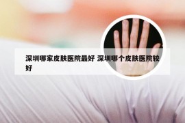 深圳哪家皮肤医院最好 深圳哪个皮肤医院较好