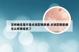 怎样确定是不是点滴型银屑病 点滴型银屑病怎么样算痊愈了