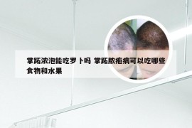 掌跖浓泡能吃罗卜吗 掌跖脓疱病可以吃哪些食物和水果