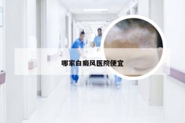 哪家白癜风医院便宜