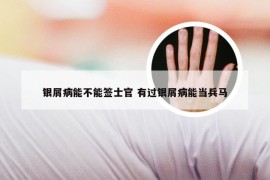 银屑病能不能签士官 有过银屑病能当兵马