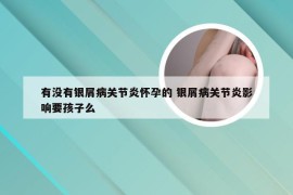 有没有银屑病关节炎怀孕的 银屑病关节炎影响要孩子么