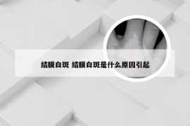 结膜白斑 结膜白斑是什么原因引起