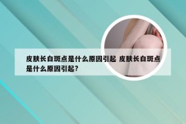 皮肤长白斑点是什么原因引起 皮肤长白斑点是什么原因引起?