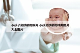 小孩子皮肤病的照片 小孩皮肤病的种类图片大全图片