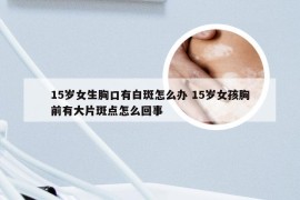 15岁女生胸口有白斑怎么办 15岁女孩胸前有大片斑点怎么回事