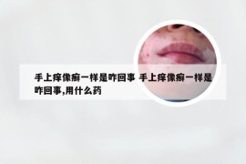 手上痒像癣一样是咋回事 手上痒像癣一样是咋回事,用什么药