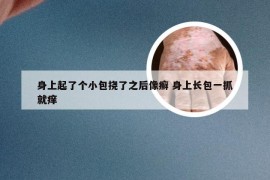 身上起了个小包挠了之后像癣 身上长包一抓就痒