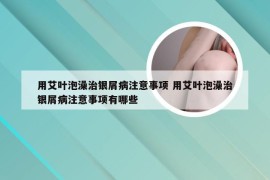 用艾叶泡澡治银屑病注意事项 用艾叶泡澡治银屑病注意事项有哪些