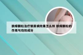 肤痒颗粒治疗银屑病效果怎么样 肤痒颗粒的作用与功效成分