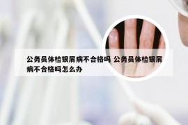 公务员体检银屑病不合格吗 公务员体检银屑病不合格吗怎么办