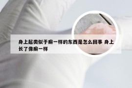 身上起类似于癣一样的东西是怎么回事 身上长了像癣一样