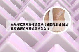 潍坊哪家医院治疗银屑病权威医院地址 潍坊银屑病研究院看银屑病怎么样