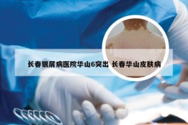 长春银屑病医院华山6突出 长春华山皮肤病