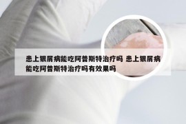 患上银屑病能吃阿普斯特治疗吗 患上银屑病能吃阿普斯特治疗吗有效果吗