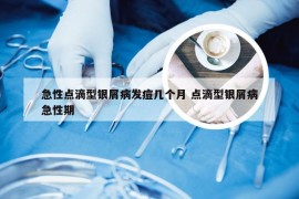 急性点滴型银屑病发痘几个月 点滴型银屑病急性期