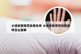 小孩皮肤突然出现白块 小孩皮肤突然出现白块怎么回事