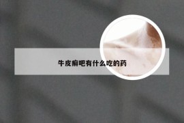 牛皮癣吧有什么吃的药