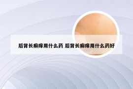 后背长癣痒用什么药 后背长癣痒用什么药好