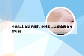 小孩脸上白斑的图片 小孩脸上出现白斑有几种可能