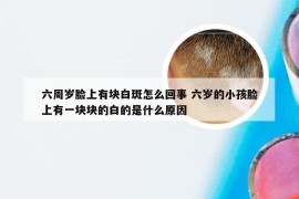 六周岁脸上有块白斑怎么回事 六岁的小孩脸上有一块块的白的是什么原因