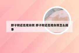 脖子附近出现白斑 脖子附近出现白斑怎么回事