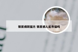 银屑病斑猫方 银屑病人能养猫吗