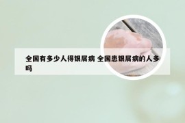 全国有多少人得银屑病 全国患银屑病的人多吗